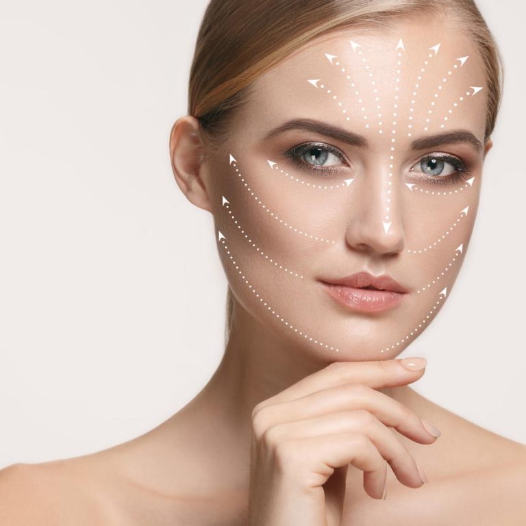 4745342955d435a6b361e2_nici-liftingujące-4D